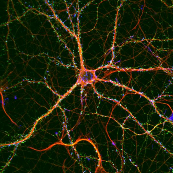 Revolutionizing Neuroscience: Precise Control of Cell Activity with Optogenetics